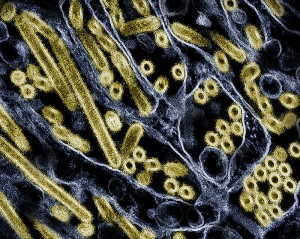 gold and blue-grey lines and squiggles of colorized influenza virus microscopy