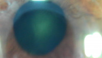 eye on the press eye see you